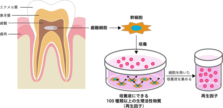 再生因子の抽出