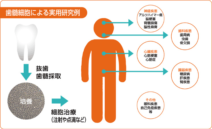 歯髄細胞による実用研究例