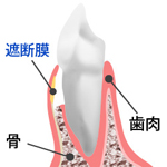 歯周病の構造
